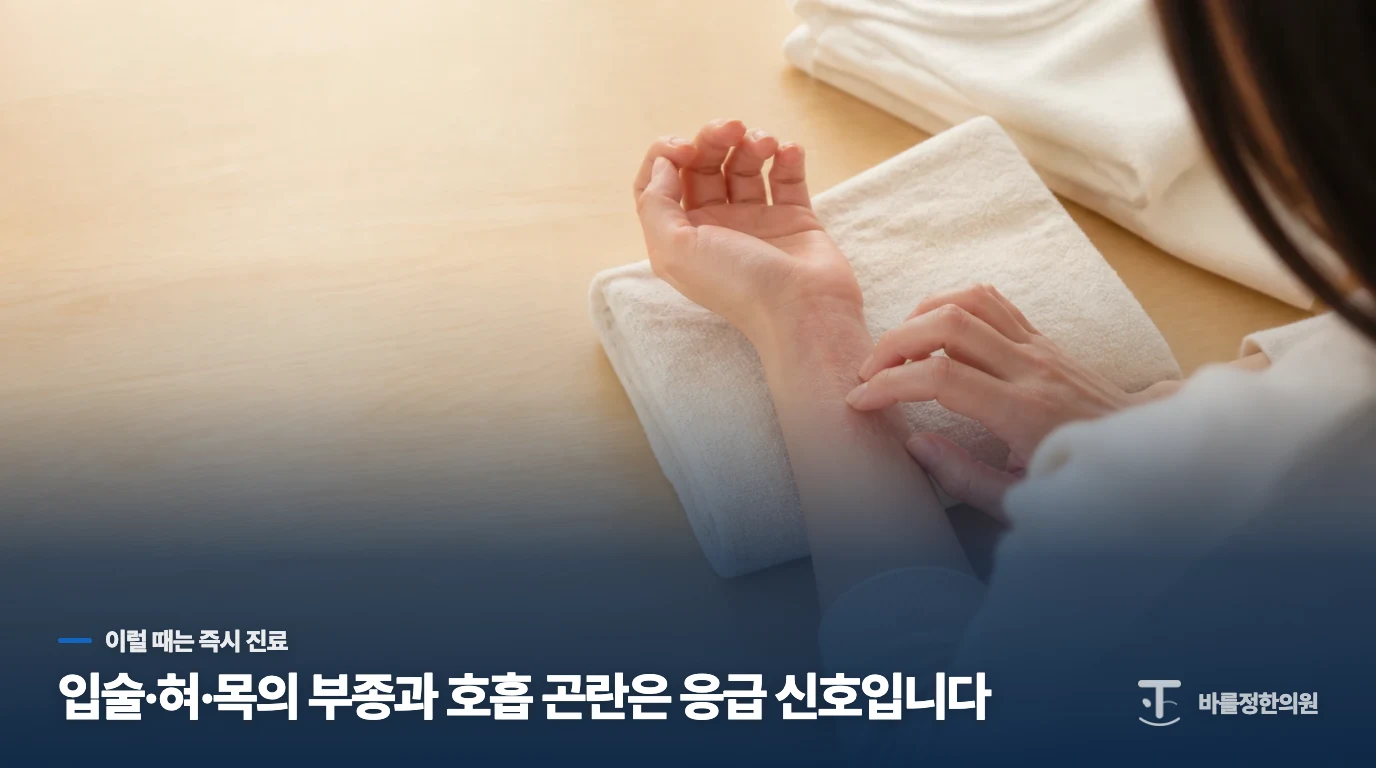 붓기와 호흡 불편이 생기면 응급 대응이 먼저입니다