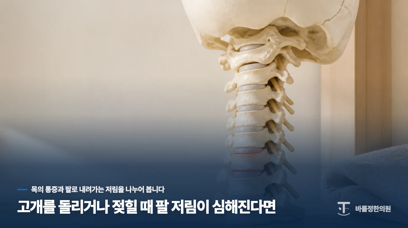 고개를 돌리거나 젖힐 때 팔 저림이 심해진다면