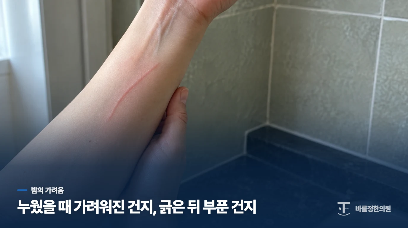 누웠을 때 가려워진 건지, 긁은 뒤 부푼 건지