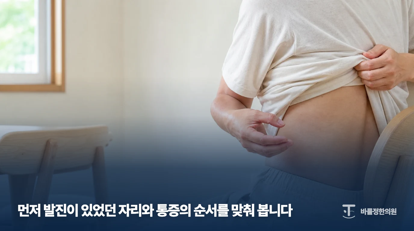 옆구리 피부가 불편한 부위를 가리키는 대상포진 뒤 통증 설명 이미지