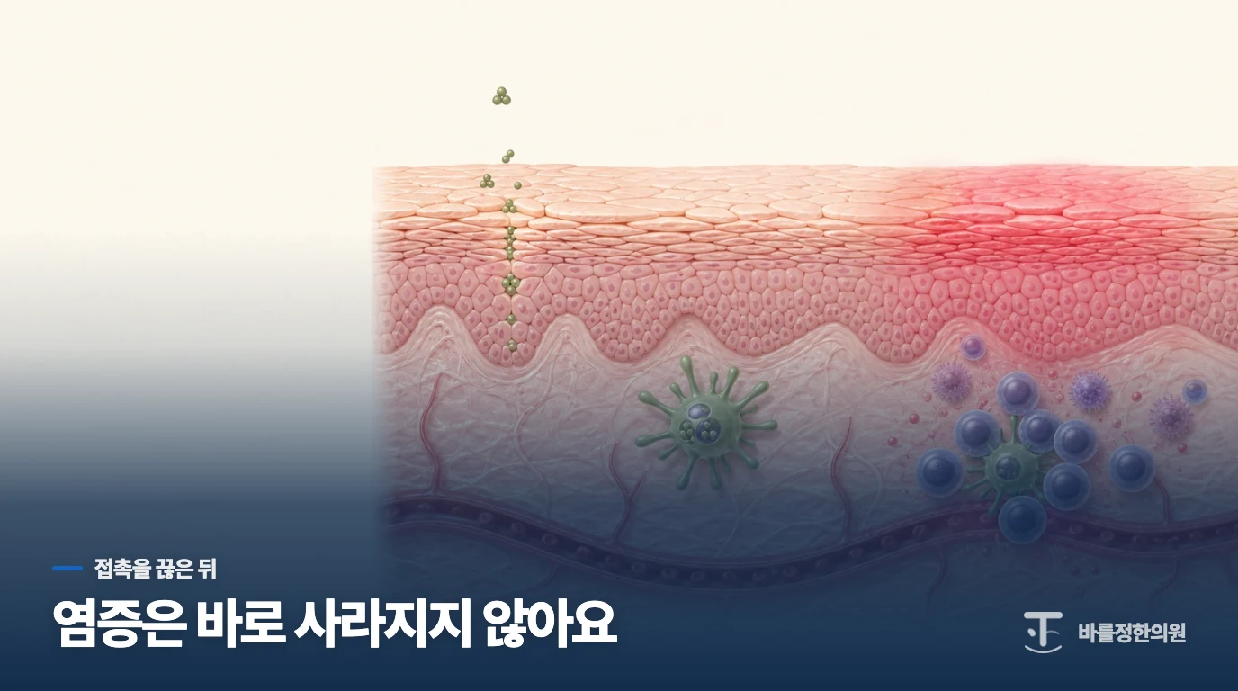 제품을 끊었는데도 피부염이 바로 사라지지 않는 이유