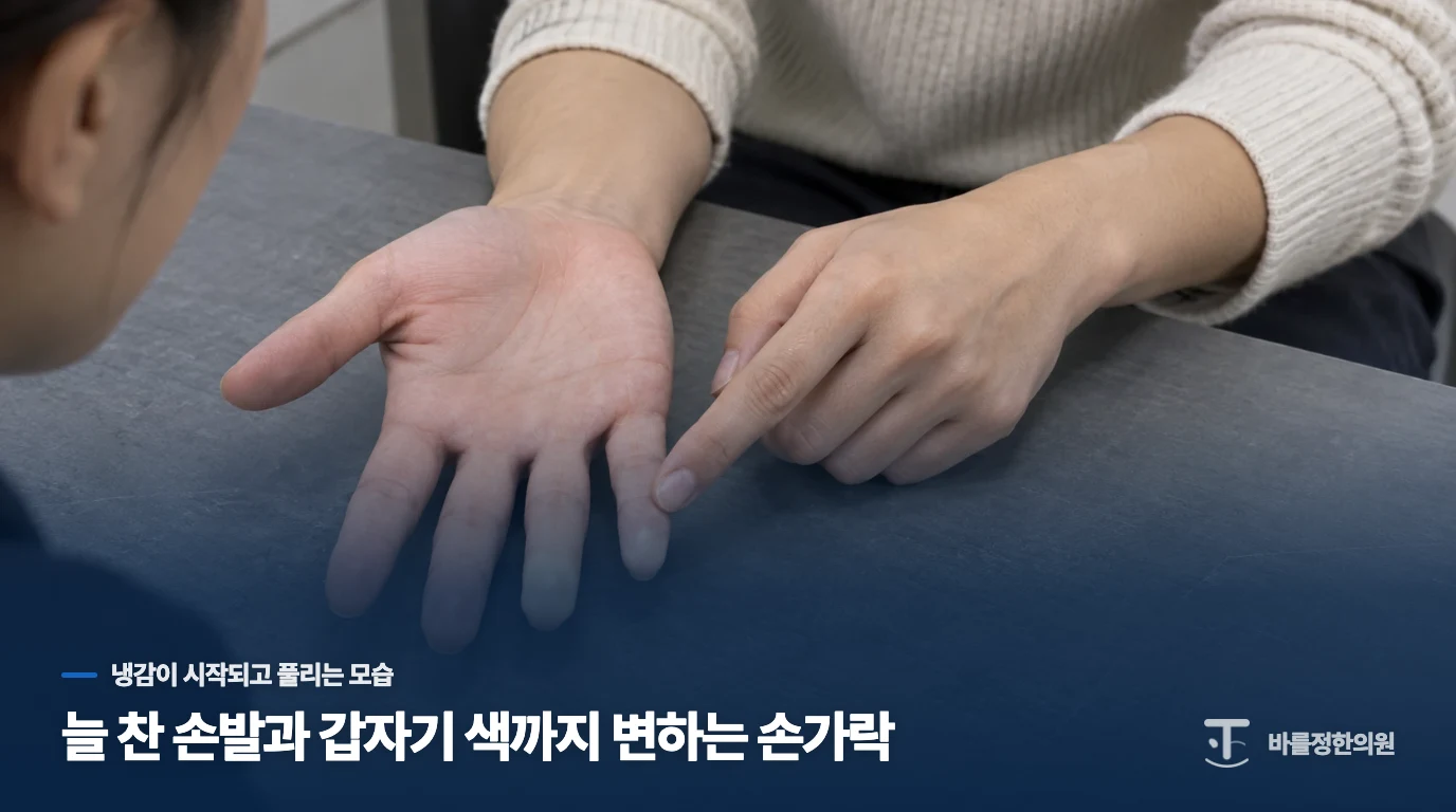 늘 찬 손발과 갑자기 색까지 변하는 손가락