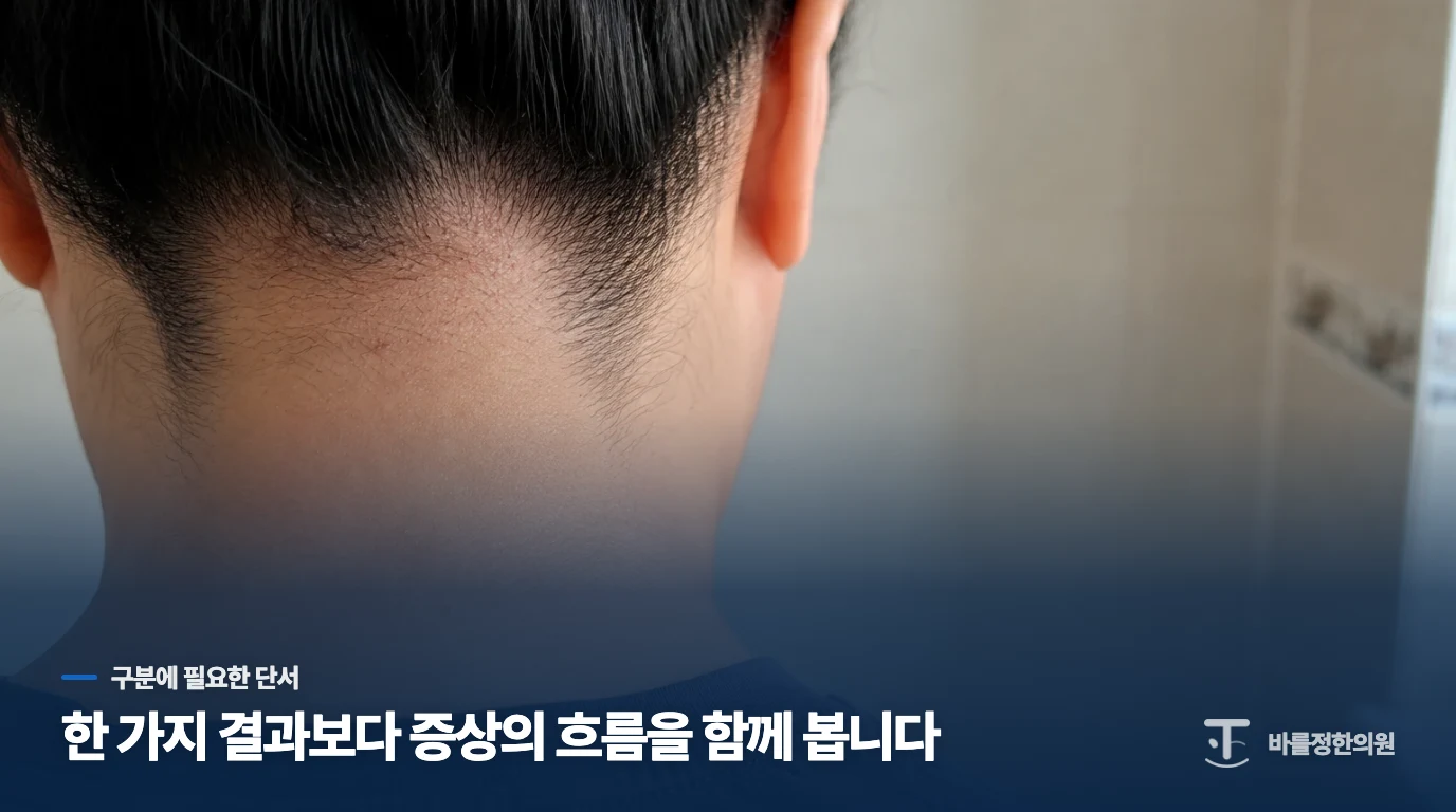 면도 뒤 올라온 좁쌀은 짜지 않는 쪽이 낫습니다