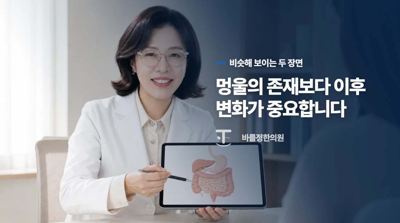 멍울 하나와 진행하는 사춘기는 다르게 보세요