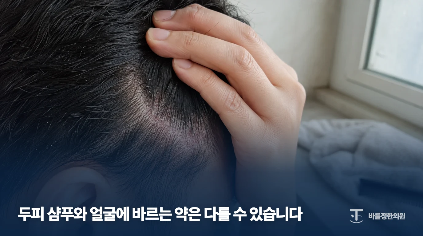 머리카락을 가르고 두피의 각질을 살펴보는 예시