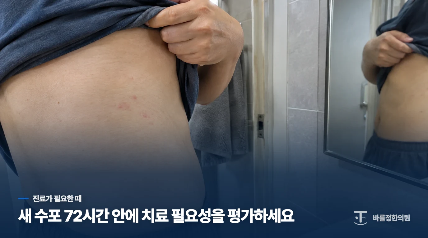 눈 주변 수포와 새 발진은 진료를 미루지 마세요