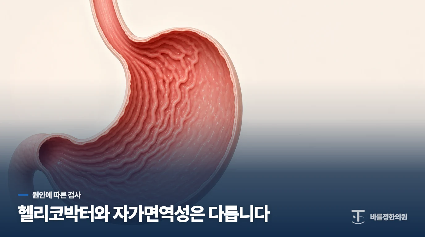 헬리코박터와 자가면역성 위염은 검사 목표가 다릅니다