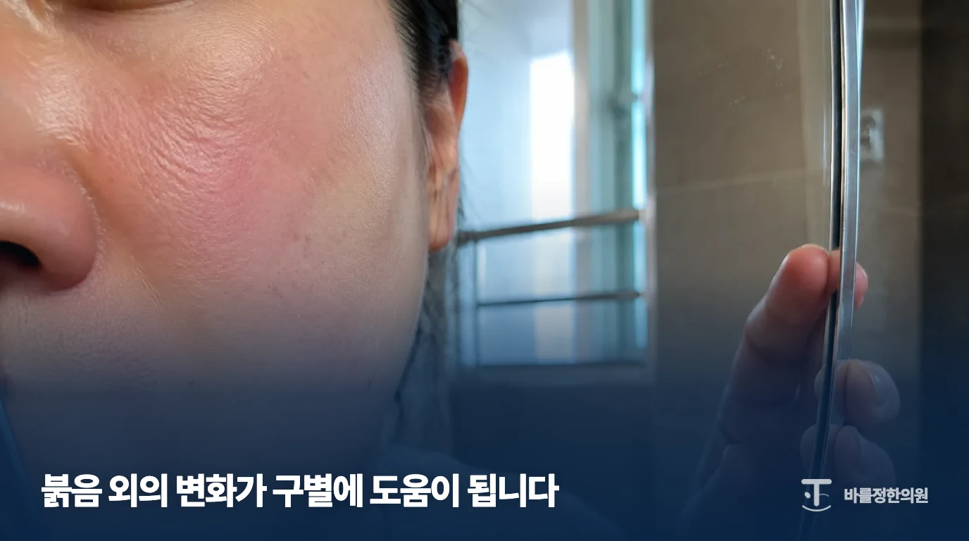 거울로 얼굴의 붉은 피부 변화를 확인하는 예시