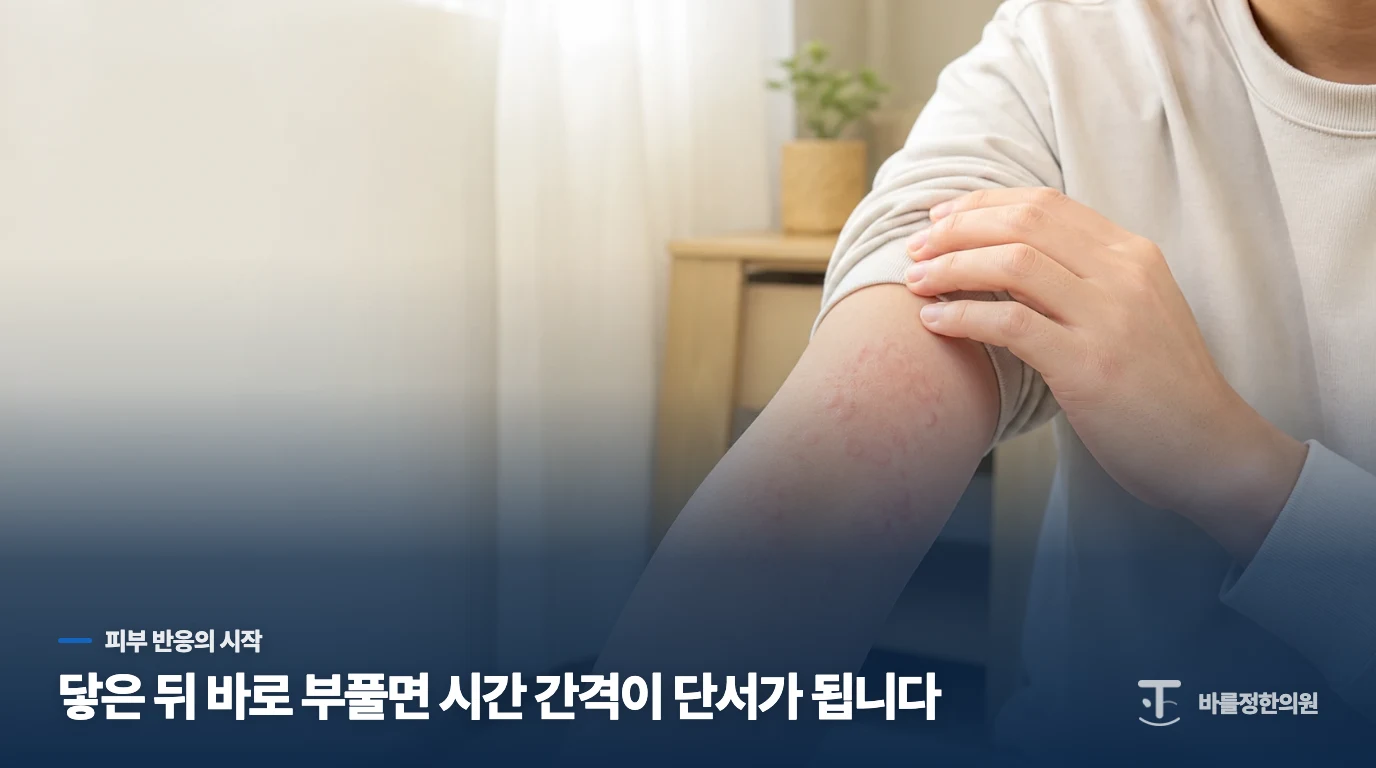 닿은 뒤 몇 분 만에 부풀었는지 살펴보세요
