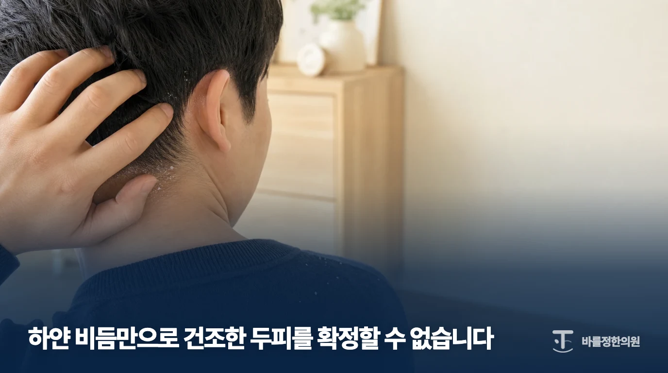 귀 뒤와 목덜미의 각질을 보여주는 지루성피부염 설명 이미지