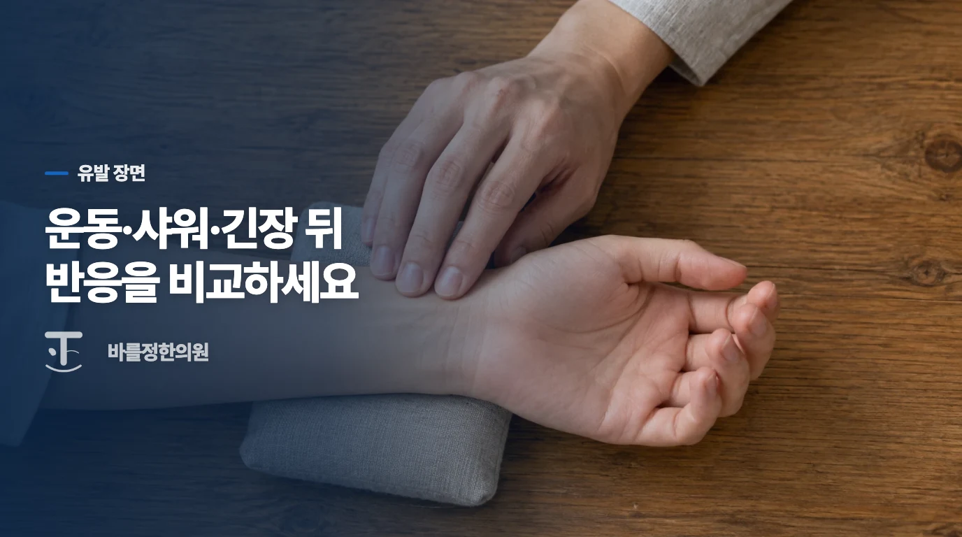 땀보다 발진을 만든 장면과 시간을 비교하세요