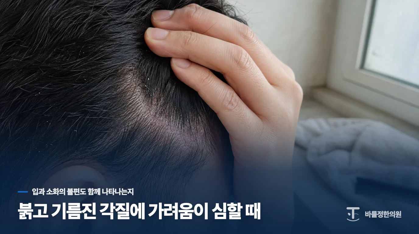 붉고 기름진 각질에 가려움이 심할 때