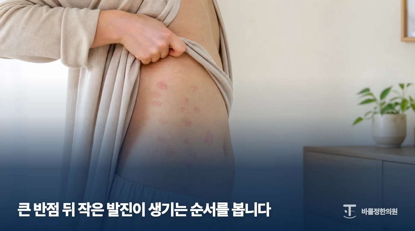 몸통에 크기가 다른 반점이 보이는 장미색비강진 설명용 이미지