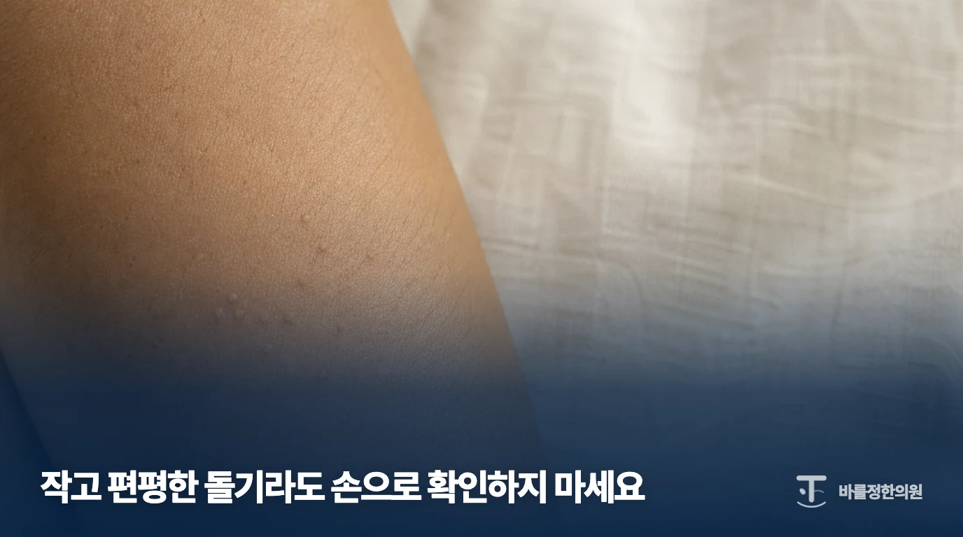 팔에 작은 피부색 돌기가 보이는 설명용 이미지로 사진만으로 진단하지 않도록 안내