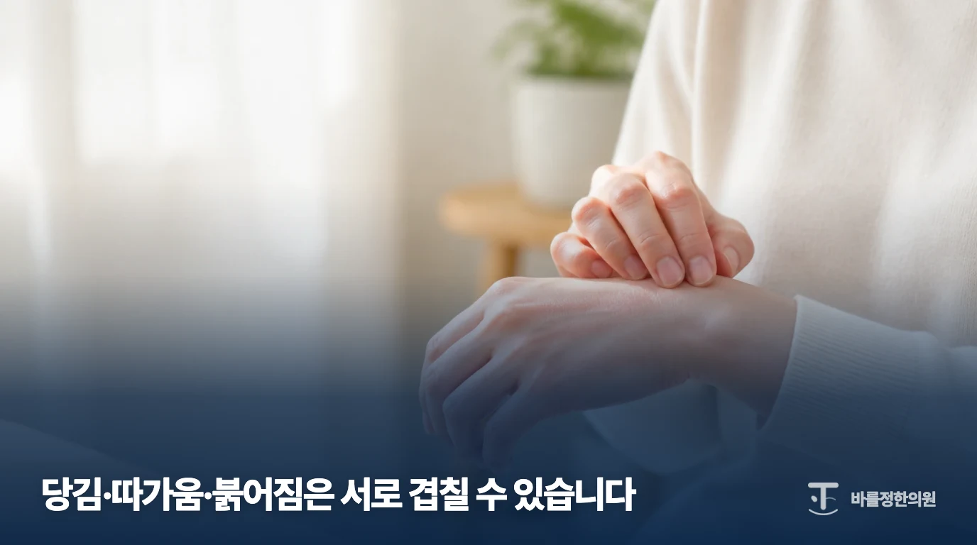 손등의 피부 상태를 살펴보는 일반적인 가려움 설명 이미지
