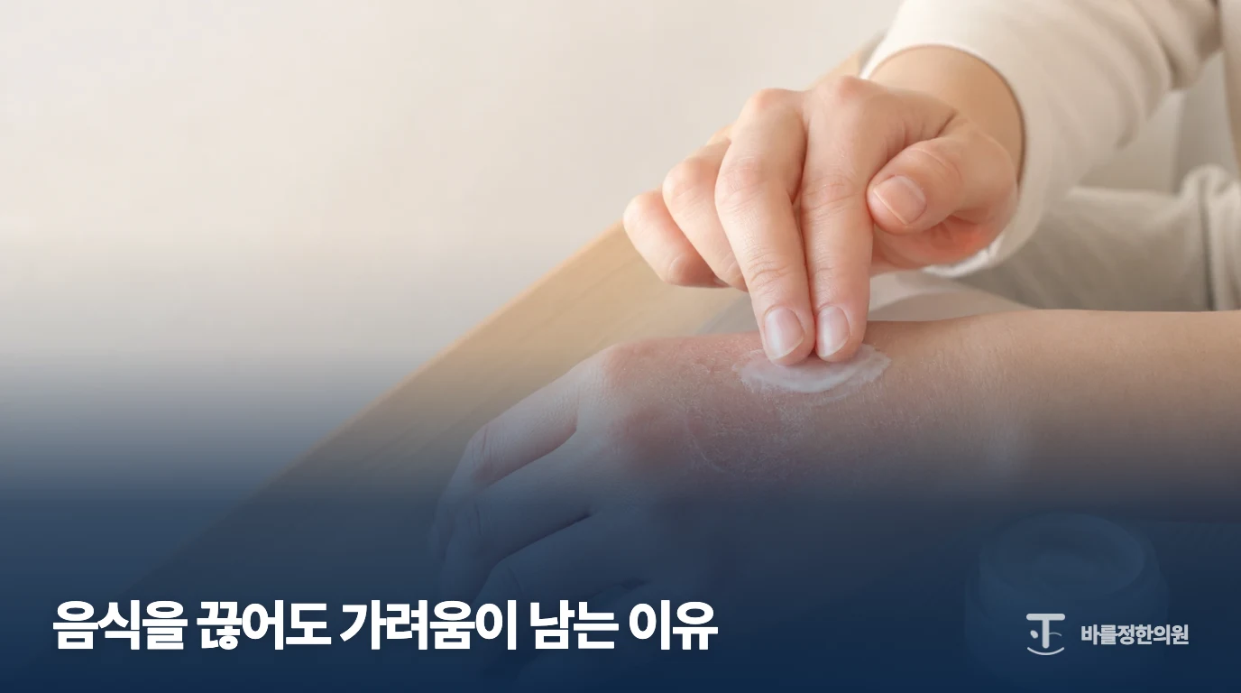 손에 보습제를 펴 바르는 피부 관리 예시