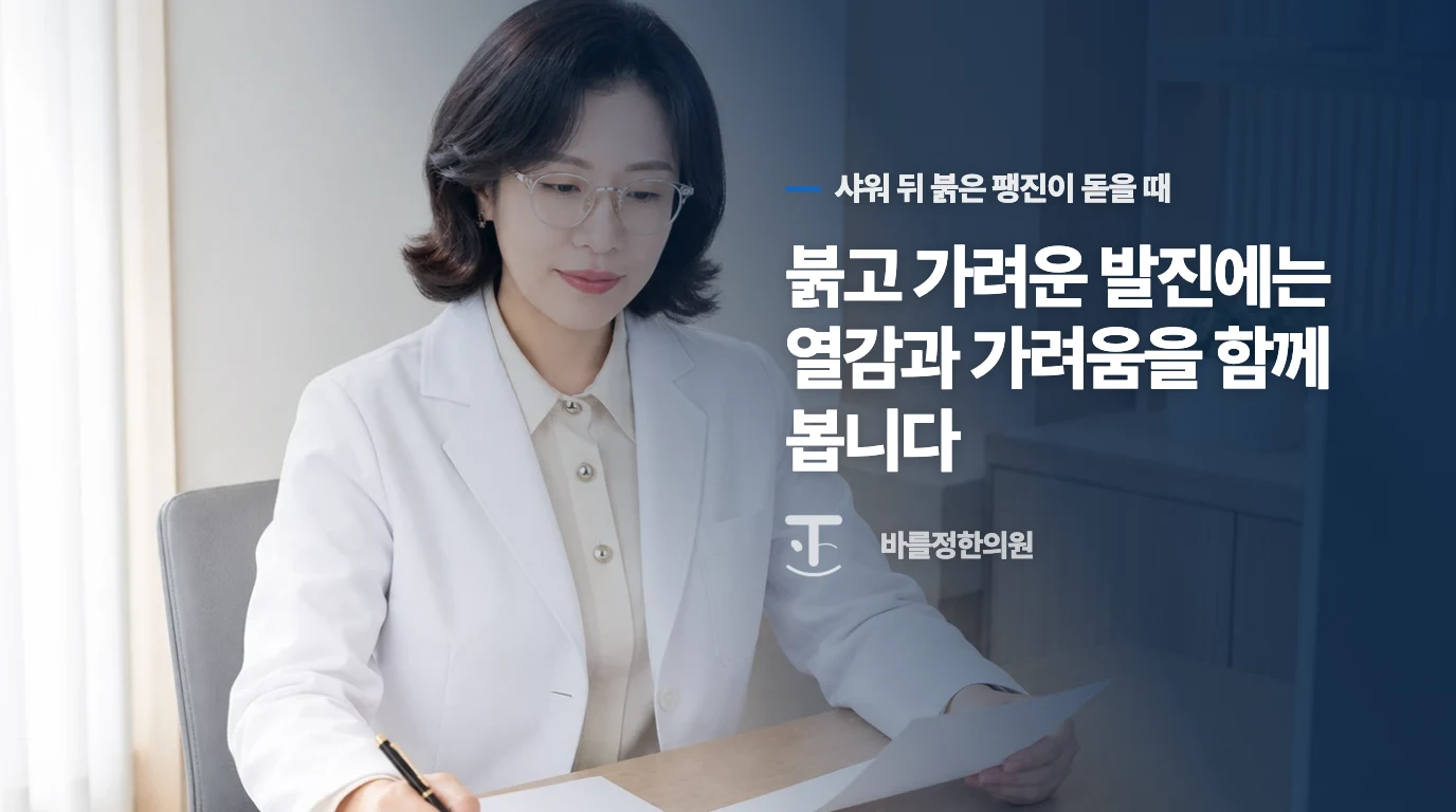 붉고 가려운 발진에는 열감과 가려움을 함께 봅니다