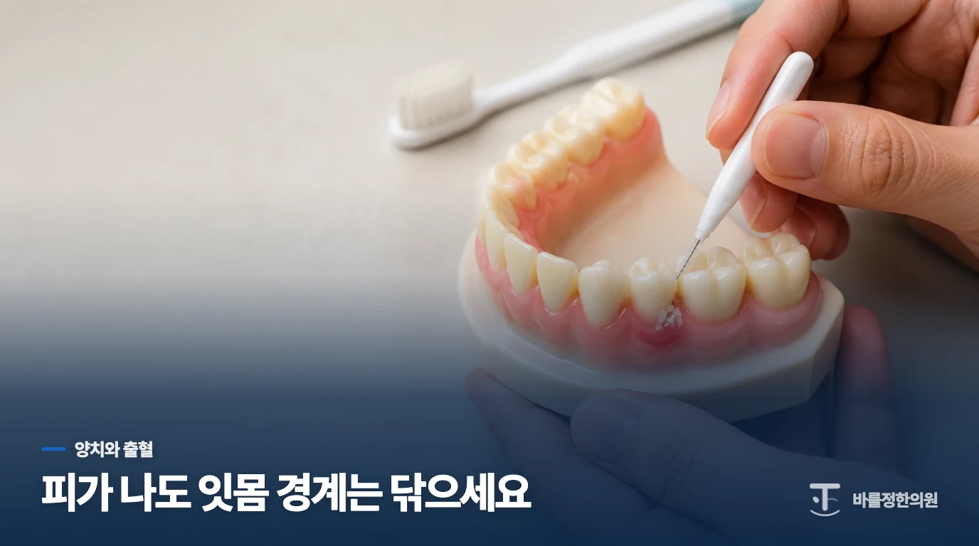 피가 나도 양치를 멈추면 안 되는 이유