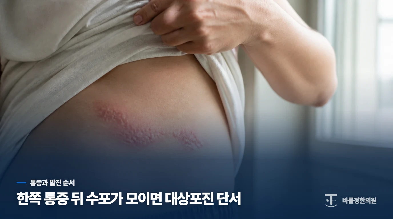 통증이 먼저였는지, 수포가 먼저였는지가 단서가 됩니다