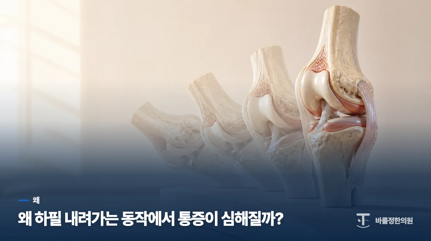 왜 하필 내려가는 동작에서 통증이 심해질까?