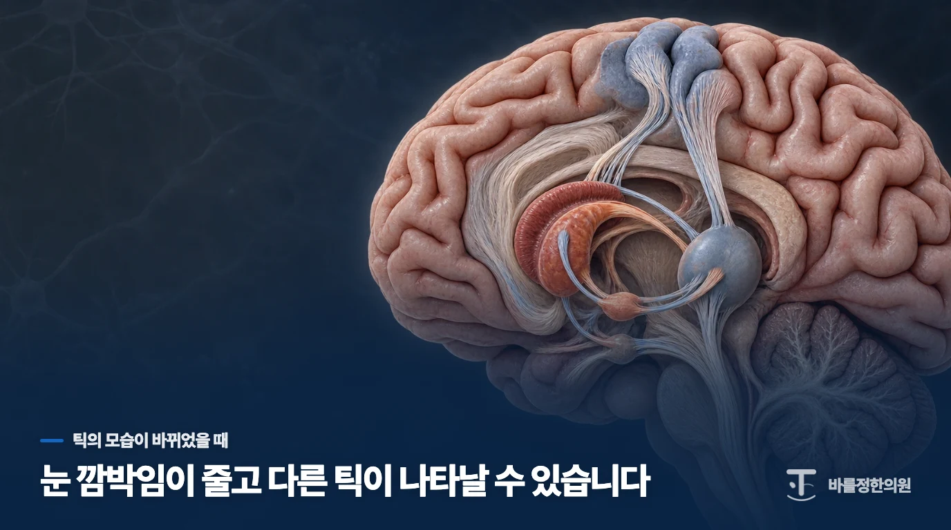 눈 깜박임이 줄고 다른 틱이 나타날 수 있습니다