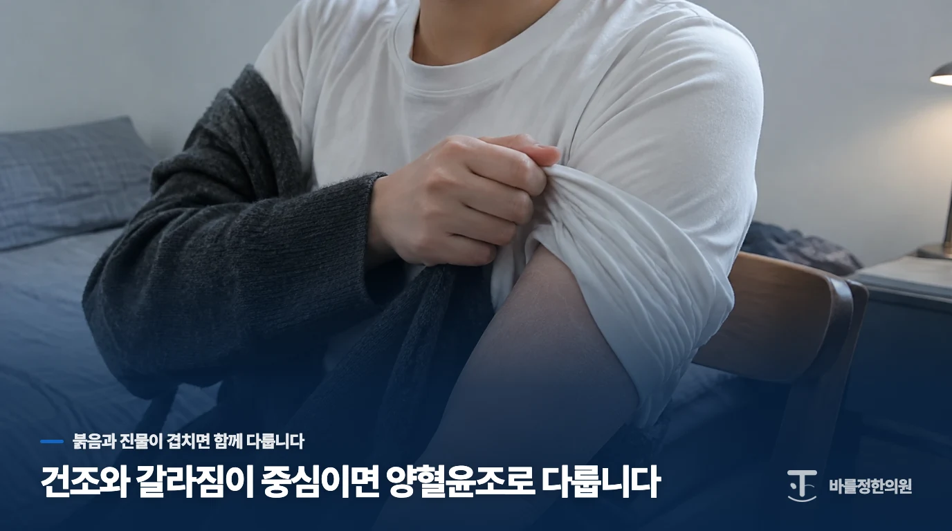 건조와 갈라짐이 중심이면 양혈윤조로 다룹니다