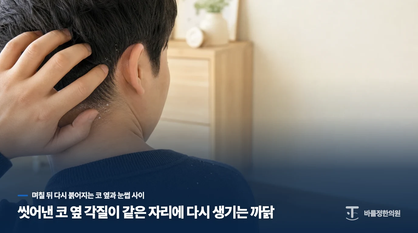 씻어낸 코 옆 각질이 같은 자리에 다시 생기는 까닭
